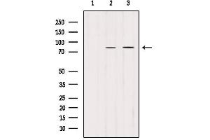 Western blot analysis of extracts from Hela, using PLOD2-Specific Antibody. (PLOD2 Antikörper  (C-Term))