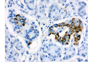 Immunohistochemistry (IHC) image for anti-Cytochrome P450, Family 24, Subfamily A, Polypeptide 1 (CYP24A1) (AA 153-514) antibody (ABIN3042784)
