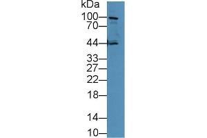 Western Blotting (WB) image for anti-Cadherin 1, Type 1, E-Cadherin (Epithelial) (CDH1) (AA 751-884) antibody (ABIN2901802)