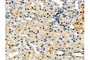 ABIN6259178 and ABIN6275070 at 1/100 staining Rat kidney tissue by IHC-P.