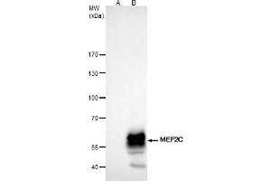 IP Image MEF2C antibody immunoprecipitates MEF2C protein in IP experiments. (MEF2C Antikörper)