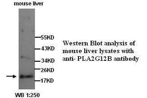 Image no. 1 for anti-Phospholipase A2, Group XIIB (PLA2G12B) (N-Term) antibody (ABIN790922) (PLA2G12B Antikörper  (N-Term))