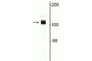 Western blot of rat hippocampal lysate showing specific immunolabeling of the ~115 kDa APP protein. (APP Antikörper  (C-Term))