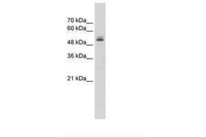 Image no. 1 for anti-Pre-mRNA Processing Factor 19 (PRPF19) (N-Term) antibody (ABIN203526) (PRP19 Antikörper  (N-Term))