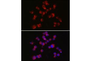 Immunofluorescence analysis of Neuro-2a cells using DCX Rabbit pAb (ABIN7266839) at dilution of 1:150 (40x lens). (Doublecortin Antikörper  (AA 240-360))