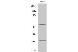 Western Blotting (WB) image for anti-CD69 (CD69) (Internal Region) antibody (ABIN3174275) (CD69 Antikörper  (Internal Region))