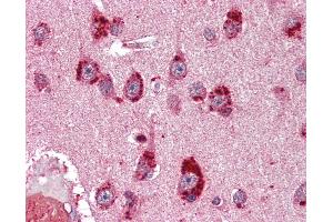 Immunohistochemistry (IHC) image for anti-Nuclear Receptor Subfamily 3, Group C, Member 2 (NR3C2) antibody (ABIN396956)