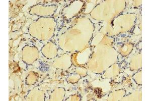 Immunohistochemistry of paraffin-embedded human thyroid tissue using ABIN7172152 at dilution of 1:100 (THRB Antikörper  (AA 1-461))