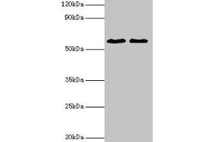 Western blot All lanes: ESR2 antibody at 2 μg/mL Lane 1: Mouse brain tissue Lane 2: PC-3 whole cell lysate Secondary Goat polyclonal to rabbit IgG at 1/10000 dilution Predicted band size: 60, 56, 36, 58, 55, 53, 49, 42, 54 kDa Observed band size: 60 kDa (ESR2 Antikörper  (AA 2-530))