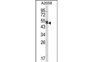 Western blot analysis of AGPAT3 Antibody in A2058 cell line lysates (35ug/lane)