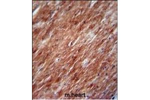 IL2 Antibody (Center) (ABIN390899 and ABIN2841106) immunohistochemistry analysis in formalin fixed and paraffin embedded mouse heart tissue followed by peroxidase conjugation of the secondary antibody and DAB staining. (IL-2 Antikörper  (AA 50-77))
