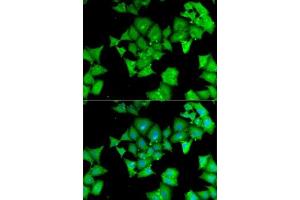Immunofluorescence analysis of MCF7 cells using  antibody (ABIN6127428, ABIN6136509, ABIN6136511 and ABIN6217463). (Aminoacylase 1 Antikörper  (AA 1-408))