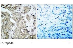 Image no. 1 for anti-Mitogen-Activated Protein Kinase Kinase 6 (MAP2K6) (pSer207) antibody (ABIN196865) (MAP2K6 Antikörper  (pSer207))