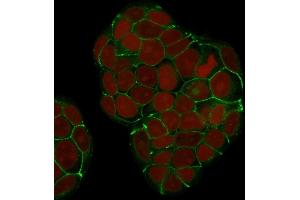 Immunofluorescence (IF) image for anti-Cadherin 1, Type 1, E-Cadherin (Epithelial) (CDH1) antibody (ABIN6941296)