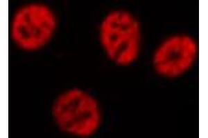 ABIN6274369 staining Hela cells by IF/ICC. (Translin Antikörper  (Internal Region))