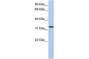 WB Suggested Anti-C12orf24 Antibody Titration: 0. (C12ORF24 Antikörper  (N-Term))