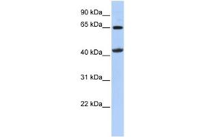 WB Suggested Anti-GATM Antibody Titration:  0. (GATM Antikörper  (Middle Region))