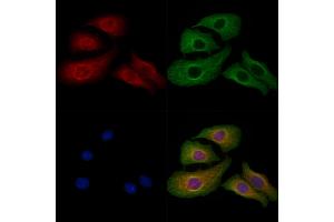 ABIN7094481 and ABIN7098530 staining Hela cells by IF/ICC. (PLP1 Antikörper  (Internal Region))