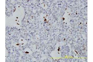 Image no. 3 for anti-Phospholipid Transfer Protein (PLTP) (AA 1-422) antibody (ABIN466078) (PLTP Antikörper  (AA 1-422))