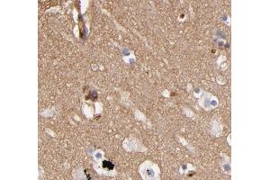 ABIN6268733 for IHC in human brain tissue (ABCB1 Antikörper  (Internal Region))