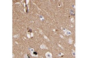 ABIN6268733 for IHC in human brain tissue (ABCB1 Antikörper  (Internal Region))