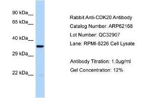 Western Blotting (WB) image for anti-Cyclin-Dependent Kinase 20 (CDK20) (Middle Region) antibody (ABIN2789045)