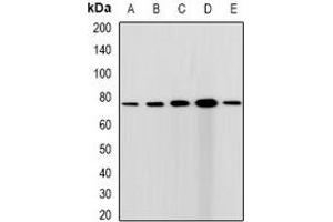 Western blot analysis of CGBP expression in HepG2 (A), Hela (B), A431 (C), mouse spleen (D), rat testis (E) whole cell lysates.