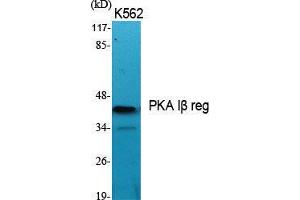 Western Blot (WB) analysis of specific cells using PKA Ibeta reg Polyclonal Antibody. (PKA Ibeta Reg (Internal Region) Antikörper)