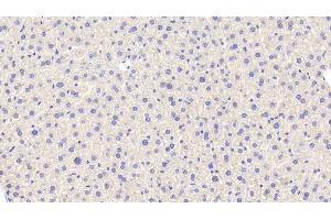 Detection of CAT in Mouse Liver Tissue using Polyclonal Antibody to Catalase (CAT) (Catalase Antikörper  (AA 80-239))