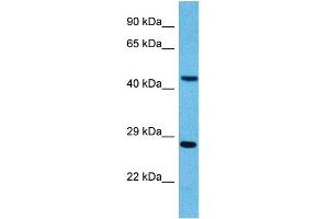 Host:  Mouse  Target Name:  PYGO2  Sample Tissue:  Mouse Pancreas  Antibody Dilution:  1ug/ml (PYGO2 Antikörper  (N-Term))