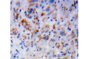 Used in DAB staining on fromalin fixed paraffin-embedded Liver tissue (IL7R Antikörper  (AA 48-217))