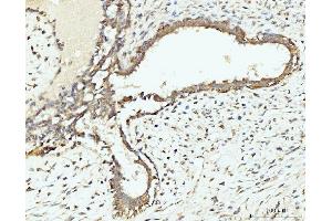IHC analysis of RPL29 using anti-RPL29 antibody (ABIN7600993). (RPL29 Antikörper  (AA 27-153))