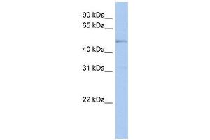 TBC1D10C antibody used at 1 ug/ml to detect target protein. (Carabin Antikörper  (N-Term))