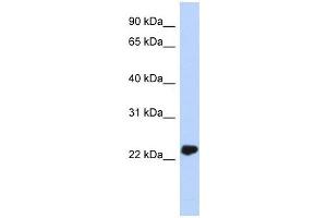UCHL3 antibody used at 1 ug/ml to detect target protein. (UCHL3 Antikörper)