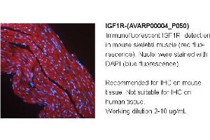 Image no. 1 for anti-Insulin-Like Growth Factor 1 Receptor (IGF1R) (Middle Region) antibody (ABIN2792087) (IGF1R Antikörper  (Middle Region))
