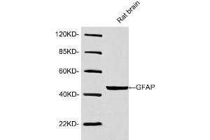 Western blot analysis of lysates using Rabbit Anti-GFAP Polyclonal Antibody (ABIN398827, 1 µg/mL) The signal was developed with IRDye-800 Conjugated Goat Anti-Rabbit IgG. (GFAP Antikörper  (AA 250-300))