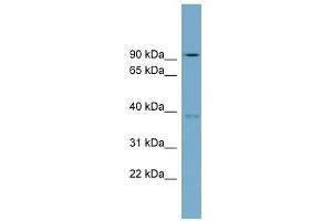 RTDR1 antibody used at 1 ug/ml to detect target protein. (RTDR1 Antikörper  (N-Term))