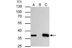 Immunoprecipitation (IP) image for anti-Thymidylate Synthetase (TYMS) antibody (ABIN2855587)