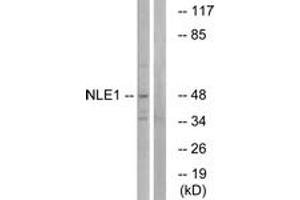 Western blot analysis of extracts from COS cells, using NLE1 Antibody. (NLE1 Antikörper  (AA 301-350))