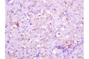 paraformaldehyde-fixed, paraffin embedded mouse placenta tissue, Antigen retrieval by boiling in sodium citrate buffer(pH6) for 15min, Block endogenous peroxidase by 3% hydrogen peroxide for 30 minutes, Blocking buffer (normal goat serum) at 37°C for 20min, Antibody incubation with Rabbit Anti-Integrin alpha 5 Polyclonal Antibody, Unconjugated  at 1:400 overnight at 4°C, followed by a conjugated secondary and DAB staining (ITGA5 Antikörper  (AA 1021-1099))