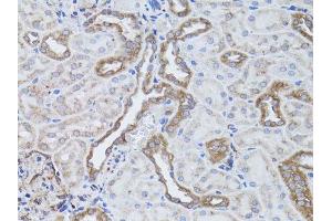 Immunohistochemistry of paraffin-embedded rat kidney using ITGAV antibody. (CD51 Antikörper  (C-Term))
