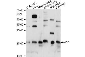 Western blot analysis of extracts of various cell lines, using AVP antibody. (Vasopressin Antikörper)