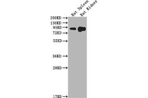 Western Blot Positive WB detected in: Rat Spleen tissue, Rat Kidney tissue All lanes: Ace2 antibody at 1:2000 Secondary Goat polyclonal to rabbit IgG at 1/50000 dilution Predicted band size: 93 kDa Observed band size: 93 kDa (ACE2 Antikörper  (AA 105-118))