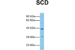 Host:  Rabbit  Target Name:  SCD  Sample Tissue:  Human Jurkat  Antibody Dilution:  1. (SCD Antikörper  (Middle Region))