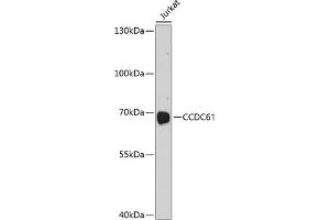 Western blot analysis of extracts of Jurkat cells, using CCDC61 antibody (ABIN6133303, ABIN6138042, ABIN6138043 and ABIN6214563) at 1:1000 dilution. (CCDC61 Antikörper  (AA 352-531))