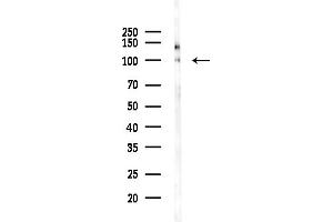 Western blot analysis of lysates from HepG2 cells, using LIV-1/ZIP6 Antibody at 1/1000 dilution.