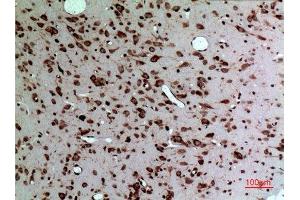 Immunohistochemistry (IHC) analysis of paraffin-embedded Rat Brain, antibody was diluted at 1:100. (Midkine Antikörper  (Internal Region))