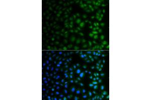 Immunofluorescence analysis of A549 cell using NAA40 antibody.
