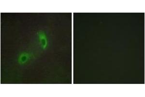 Immunofluorescence analysis of HuvEc cells, using HGS Antibody. (HGS Antikörper  (AA 451-500))