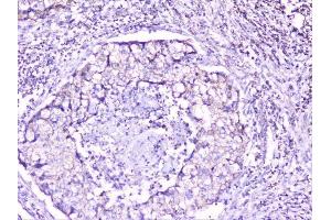 IHC analysis of cortactin using anti-cortactin antibody (ABIN6719306).